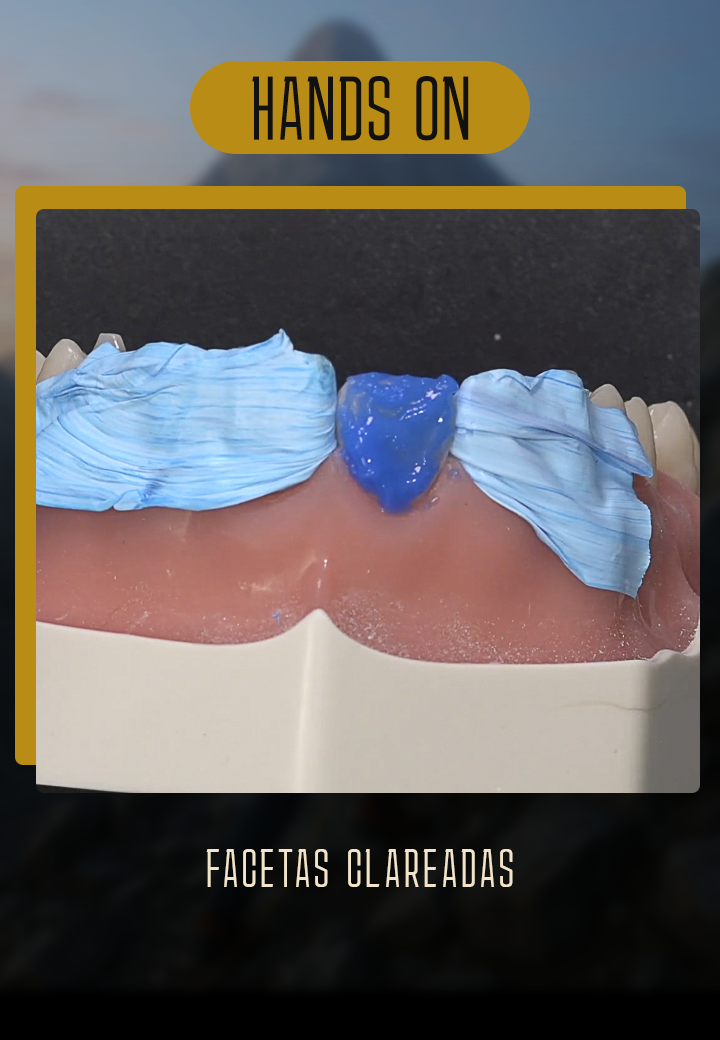 facetas-clareadas-trilha