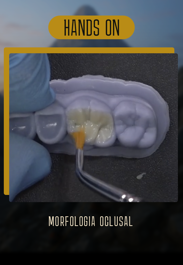 trilha-morfologia-oclusal